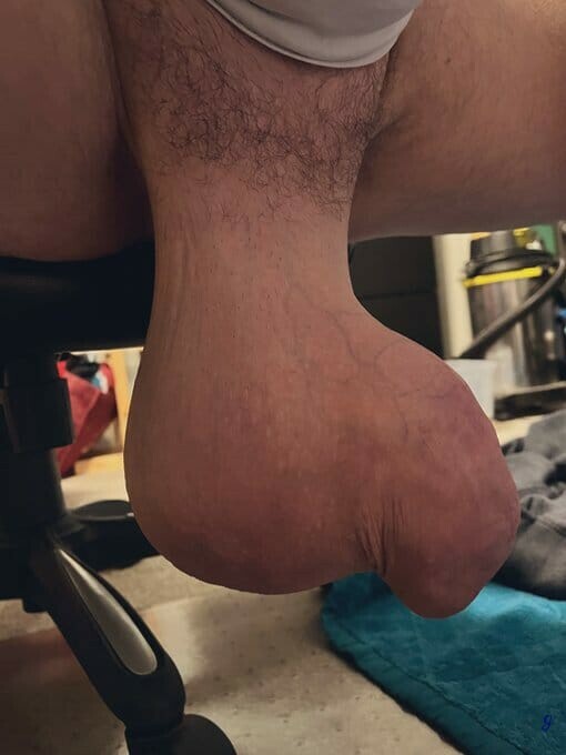 monster cock saline silicone enlargement — 34